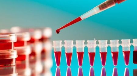آزمایش خون 🔗