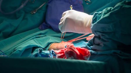 جراحی های قلب 🔗