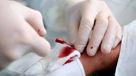 آنژیوگرافی و کاتتریسم 🔗