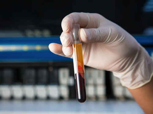 آزمایش انعقاد خون